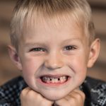 dentista dei bambini