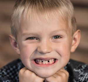 dentista dei bambini